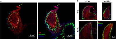 Regional Variation in Androgen Receptor Expression and Biomechanical Properties May Contribute to Cryptorchidism Susceptibility in the LE/orl Rat